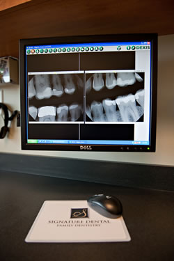 xray